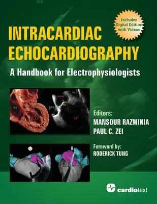 Echokardiografia wewnątrzsercowa: Podręcznik dla elektrofizjologów - Intracardiac Echocardiography: A Handbook for Electrophysiologists