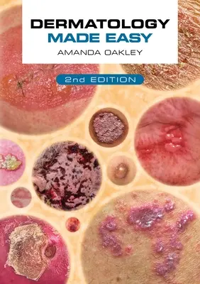 Łatwa dermatologia, wydanie drugie - Dermatology Made Easy, Second Edition