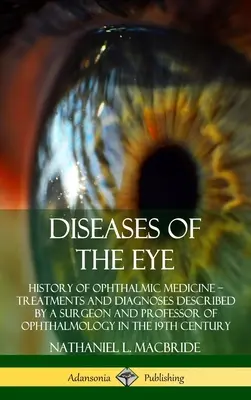 Diseases of the Eye: History of Ophthalmic Medicine - Treatments and Diagnoses described by a Surgeon and Professor of Ophthalmology in the - Diseases of the Eye: History of Ophthalmic Medicine - Treatments and Diagnoses Described by a Surgeon and Professor of Ophthalmology in the