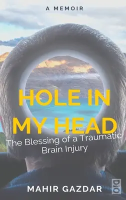 Dziura w mojej głowie: błogosławieństwo traumatycznego urazu mózgu - Hole in My Head: The Blessing of a Traumatic Brain Injury