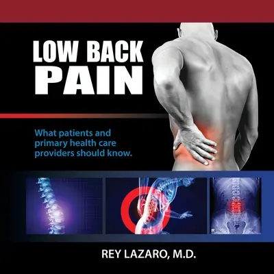 Niski ból pleców - co powinni wiedzieć pacjenci i świadczeniodawcy podstawowej opieki zdrowotnej - Low Back Pain, What patients and primary care health care providers should know
