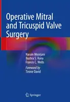 Operacyjna chirurgia zastawki mitralnej i trójdzielnej - Operative Mitral and Tricuspid Valve Surgery