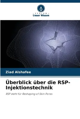 przegląd techniki wtrysku RSP - berblick ber die RSP-Injektionstechnik