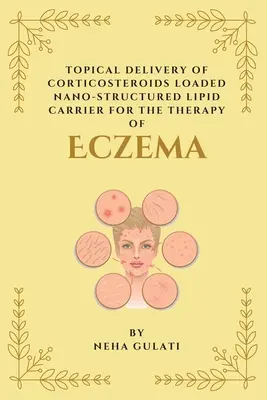 Miejscowe dostarczanie kortykosteroidów z nanostrukturalnym nośnikiem lipidowym w terapii egzemy - Topical Delivery of Corticosteroids Loaded Nanostructured Lipid Carrier for the Therapy of Eczema