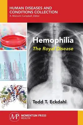 Hemofilia: Królewska choroba - Hemophilia: The Royal Disease