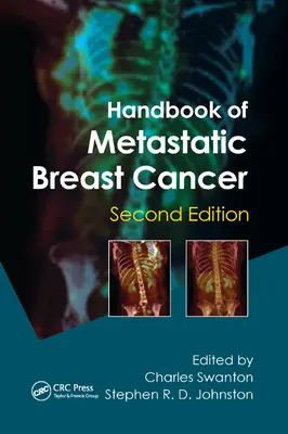 Podręcznik przerzutowego raka piersi - Handbook of Metastatic Breast Cancer