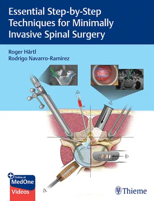 Podstawowe techniki minimalnie inwazyjnej chirurgii kręgosłupa krok po kroku - Essential Step-By-Step Techniques for Minimally Invasive Spinal Surgery