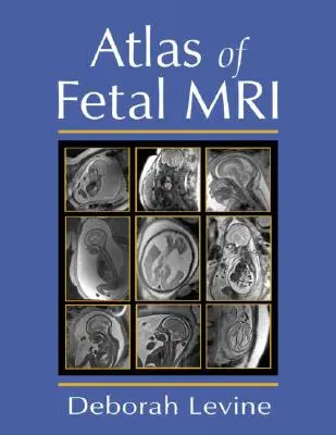 Atlas rezonansu magnetycznego płodu - Atlas of Fetal MRI