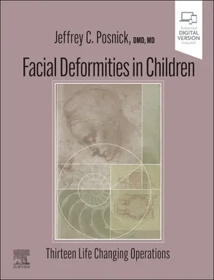 Deformacje twarzy u dzieci: Trzynaście operacji zmieniających życie - Facial Deformities in Children: Thirteen Life Changing Operations