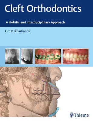 Ortodoncja rozszczepów: Holistyczne i interdyscyplinarne podejście - Cleft Orthodontics: A Holistic and Interdisciplinary Approach