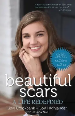 Piękne blizny: Życie na nowo zdefiniowane - Beautiful Scars: A Life Redefined