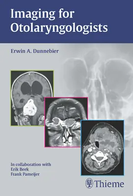 Obrazowanie dla otolaryngologów - Imaging for Otolaryngologists