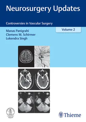 Neurosurgery Updates, Vol. 2: Kontrowersje w chirurgii naczyniowej - Neurosurgery Updates, Vol. 2: Controversies in Vascular Surgery