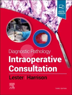 Patologia diagnostyczna: Konsultacja śródoperacyjna - Diagnostic Pathology: Intraoperative Consultation