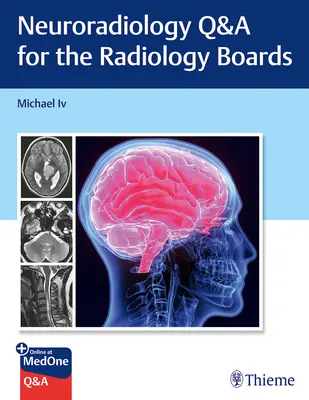 Pytania i odpowiedzi dotyczące neuroradiologii na egzaminach z radiologii - Neuroradiology Q&A for the Radiology Boards