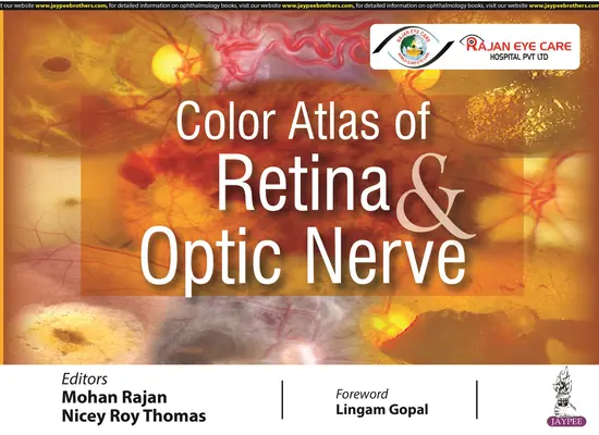 Kolorowy atlas siatkówki i nerwu wzrokowego - Color Atlas of Retina & Optic Nerve