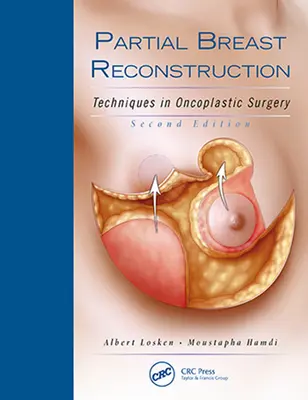 Częściowa rekonstrukcja piersi: Techniki w chirurgii onkoplastycznej - Partial Breast Reconstruction: Techniques in Oncoplastic Surgery