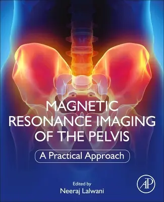 Rezonans magnetyczny miednicy: Praktyczne podejście - Magnetic Resonance Imaging of the Pelvis: A Practical Approach