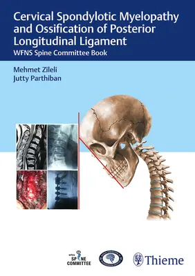 Mielopatia kręgosłupa szyjnego i kostnienie więzadła podłużnego tylnego: Wfns Spine Committee Book - Cervical Spondylotic Myelopathy and Ossification of Posterior Longitudinal Ligament: Wfns Spine Committee Book