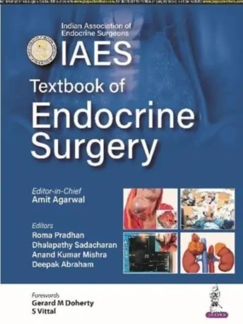 Podręcznik chirurgii endokrynologicznej - Textbook of Endocrine Surgery