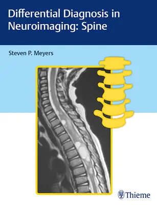 Diagnostyka różnicowa w neuroobrazowaniu: Kręgosłup - Differential Diagnosis in Neuroimaging: Spine