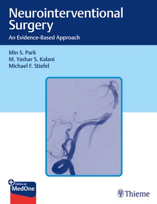 Chirurgia neurointerwencyjna: Podejście oparte na dowodach - Neurointerventional Surgery: An Evidence-Based Approach
