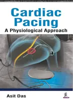 Fizjologiczne podejście do stymulacji serca - Cardiac Pacing a Physiological Approach