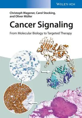 Sygnał nowotworowy: Od biologii molekularnej do terapii celowanej - Cancer Signaling: From Molecular Biology to Targeted Therapy