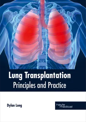 Transplantacja płuc: Zasady i praktyka - Lung Transplantation: Principles and Practice