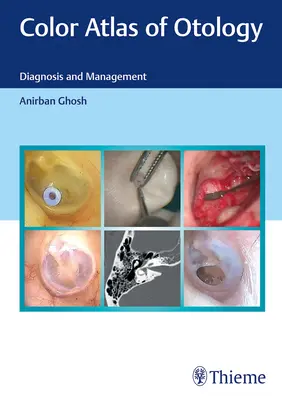 Kolorowy atlas otologii: Diagnostyka i leczenie - Color Atlas of Otology: Diagnosis and Management