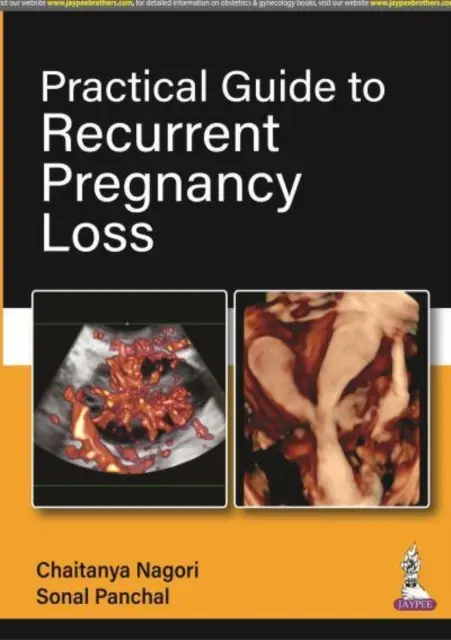 Praktyczny przewodnik po nawracającej utracie ciąży - Practical Guide to Recurrent Pregnancy Loss