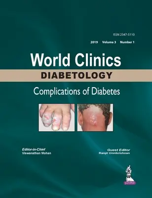 Światowe Kliniki Diabetologii: Powikłania cukrzycy - tom 3, numer 1 - World Clinics Diabetology: Complications of Diabetes - Volume 3, Number 1