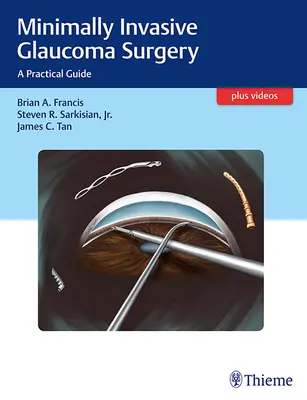 Minimalnie inwazyjna chirurgia jaskry: Praktyczny przewodnik - Minimally Invasive Glaucoma Surgery: A Practical Guide