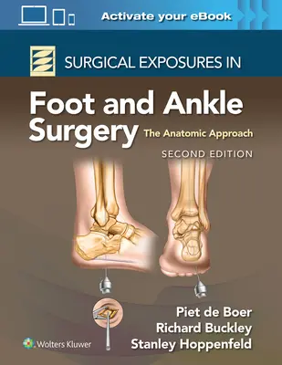 Ekspozycje chirurgiczne w chirurgii stopy i stawu skokowego: Podejście anatomiczne - Surgical Exposures in Foot and Ankle Surgery: The Anatomic Approach