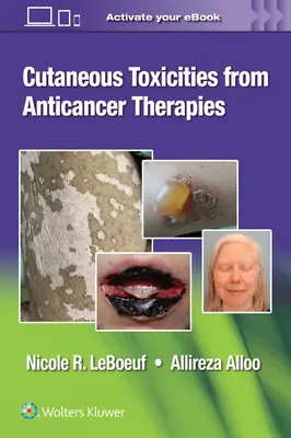 Reakcje skórne na terapie przeciwnowotworowe - Cutaneous Reactions from Anti-Cancer Therapies