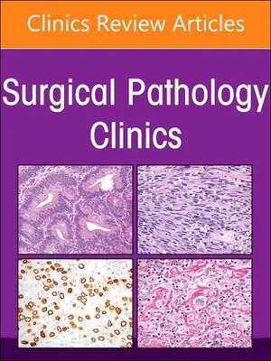 Patologia endokrynologiczna, wydanie klinik patologii chirurgicznej: Tom 16-1 - Endocrine Pathology, an Issue of Surgical Pathology Clinics: Volume 16-1