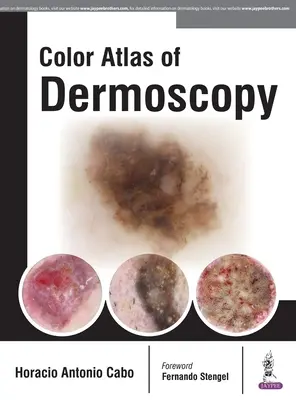 Kolorowy atlas dermoskopii - Color Atlas of Dermoscopy