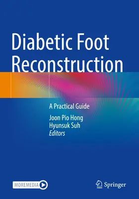 Rekonstrukcja stopy cukrzycowej: Praktyczny przewodnik - Diabetic Foot Reconstruction: A Practical Guide