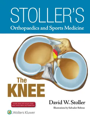 Ortopedia i medycyna sportowa Stollera: Kolano: zawiera filmy z wykładów Stollera i notatki Stollera - Stoller's Orthopaedics and Sports Medicine: The Knee: Includes Stoller Lecture Videos and Stoller Notes
