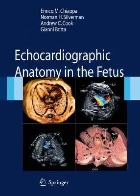 Anatomia echokardiograficzna płodu [z DVD] - Echocardiographic Anatomy in the Fetus [With DVD]