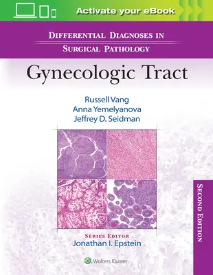 Diagnostyka różnicowa w patologii chirurgicznej: Przewód ginekologiczny - Differential Diagnoses in Surgical Pathology: Gynecologic Tract