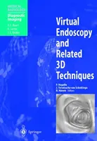 Wirtualna endoskopia i powiązane techniki 3D - Virtual Endoscopy and Related 3D Techniques