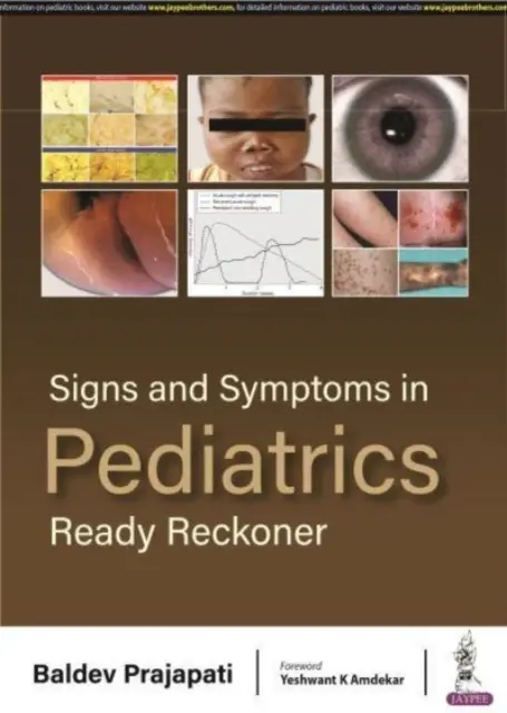 Oznaki i objawy w pediatrii - Ready Reckoner - Signs and Symptoms in Pediatrics - Ready Reckoner