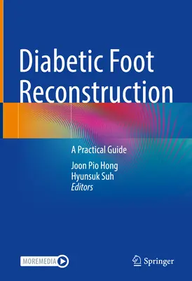 Rekonstrukcja stopy cukrzycowej: Praktyczny przewodnik - Diabetic Foot Reconstruction: A Practical Guide