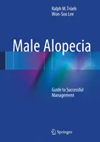 Łysienie u mężczyzn: Przewodnik po skutecznym leczeniu - Male Alopecia: Guide to Successful Management