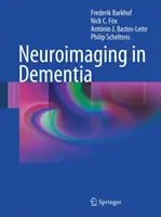 Neuroobrazowanie w demencji - Neuroimaging in Dementia