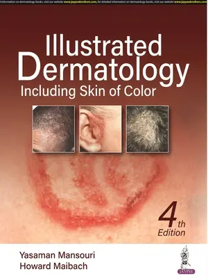 Dermatologia ilustrowana - w tym skóra kolorowa - Illustrated Dermatology - Including Skin of Colour