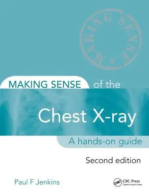 Making Sense of the Chest X-Ray: Praktyczny przewodnik - Making Sense of the Chest X-Ray: A Hands-On Guide