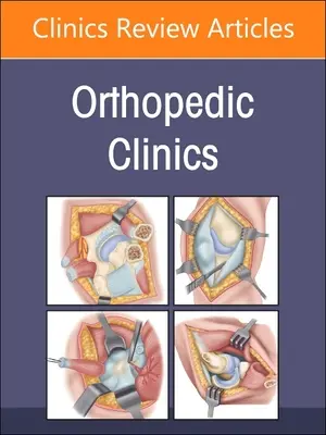 Postęp technologiczny, wydanie Klinik Ortopedycznych: Tom 54-2 - Technological Advances, an Issue of Orthopedic Clinics: Volume 54-2