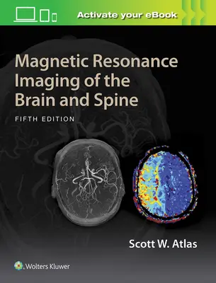 Rezonans magnetyczny mózgu i kręgosłupa - Magnetic Resonance Imaging of the Brain and Spine